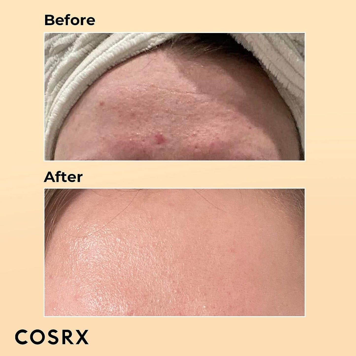 COSRX Snail Mucin 96% Power Repairing Essence 3.38 Fl.Oz 100 ML, Hydrating Serum