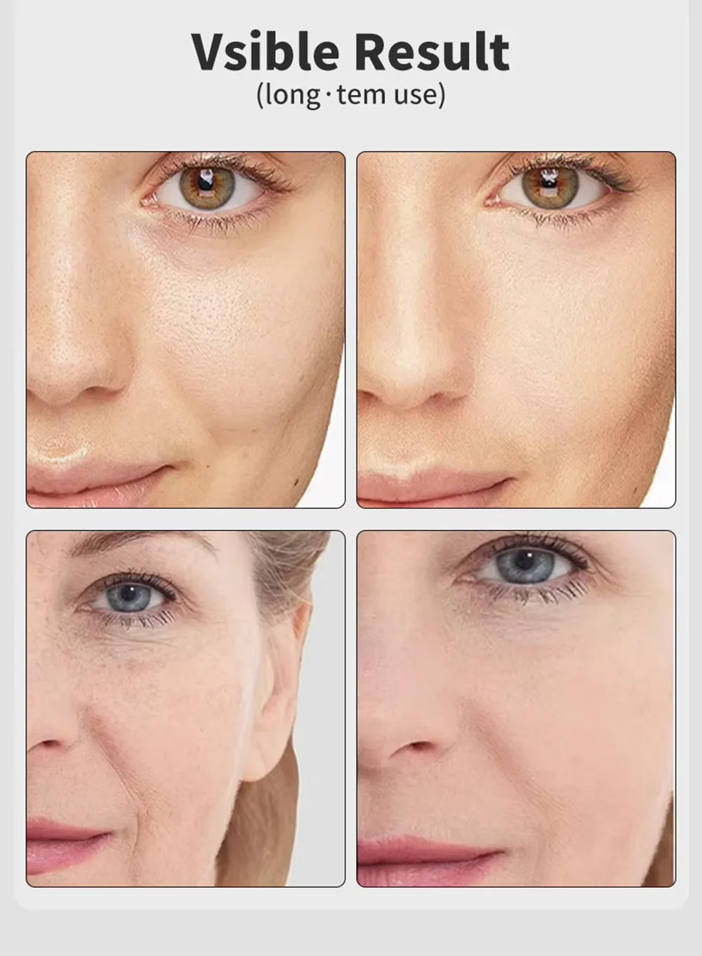 7 Colors EMS Microcurrent Facial Massager Age-R Booster Pro anti Wrinkle Lift Device Home Use Beauty Tool for Skin Care & Rejuve