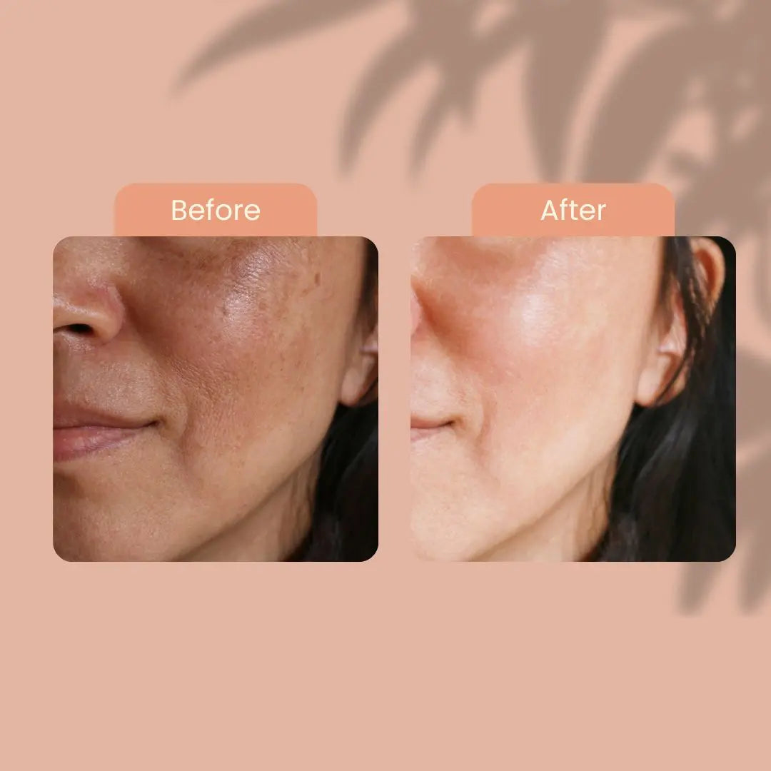 Vitamin C & Serums