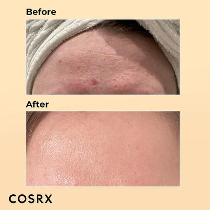 COSRX Snail Mucin 96% Power Repairing Essence 3.38 Fl.Oz 100 ML, Hydrating Serum