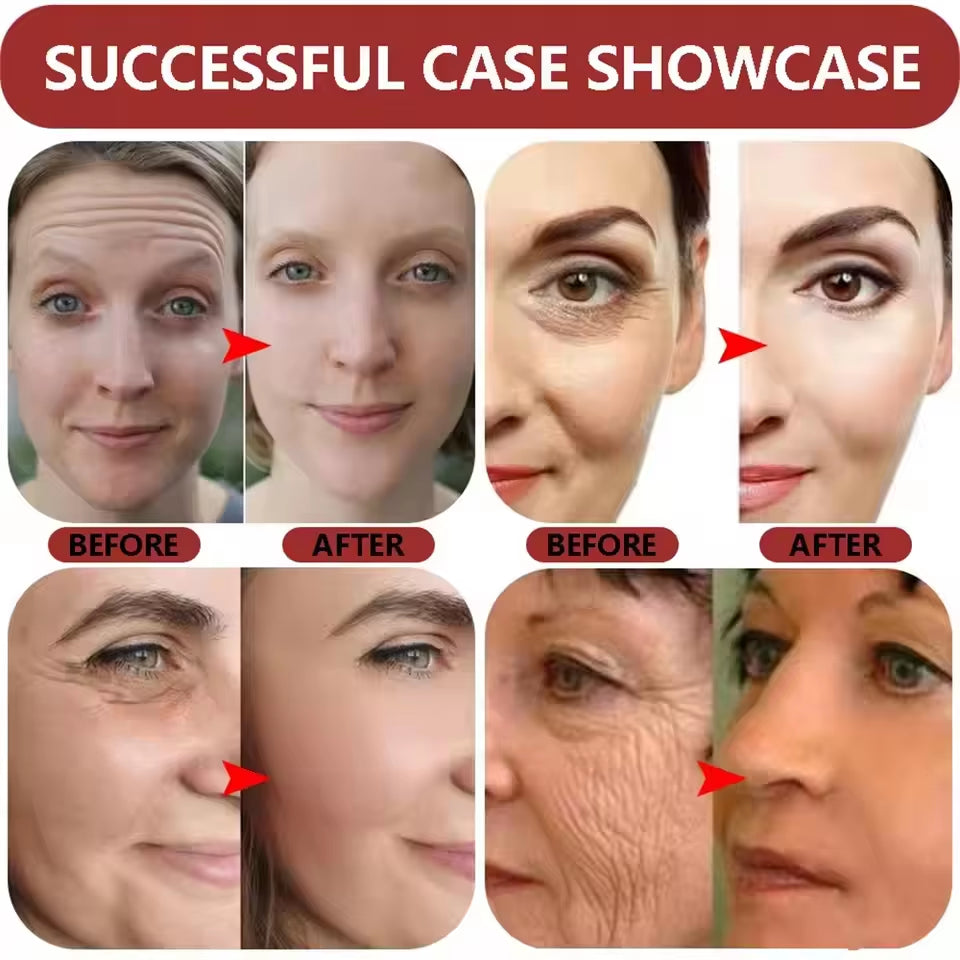 Ginseng Snail Serum anti Wrinkle Aging Eye Face Lift Tightening Moisturising Smooth Fine Lines Brighten Korean Cosmetics 30ML