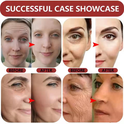 Ginseng Snail Serum anti Wrinkle Aging Eye Face Lift Tightening Moisturising Smooth Fine Lines Brighten Korean Cosmetics 30ML