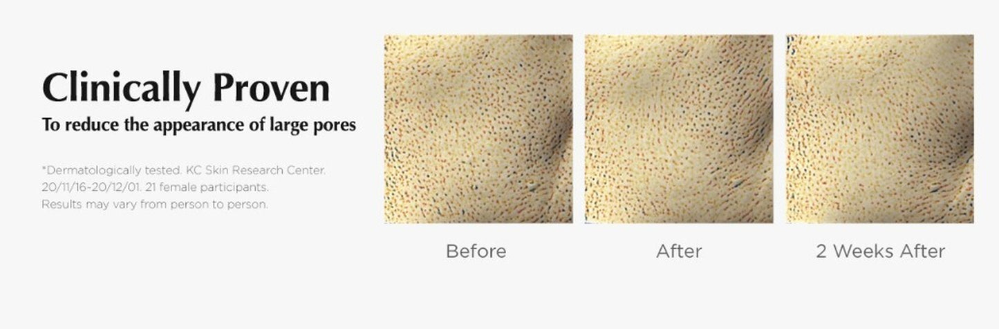 Purifying Soda Foam 